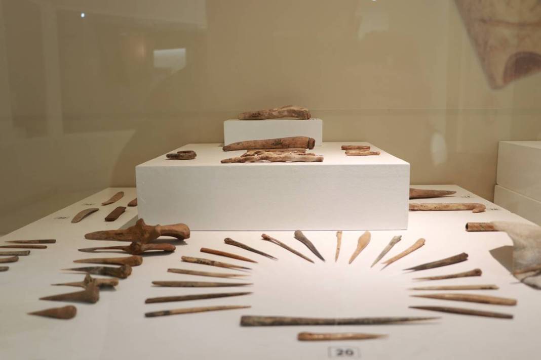 Dünyanın ilk beyin ameliyatı meğer o kentimizde yapılmış! 10 bin 500 yıl öncesine ait kafatası bulundu 9